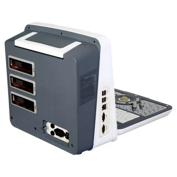 Ультразвуковой сканер AcuVista RS880d (c 3 датчиками, 14", с батареей)